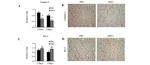 Caspase 3 Antibody in Immunohistochemistry (IHC)