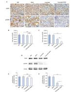 Phospho-EGFR (Tyr1086) Antibody in Western Blot, Immunohistochemistry, Immunohistochemistry (Paraffin) (WB, IHC, IHC (P))