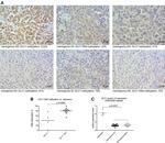 DLC1 Antibody in Immunohistochemistry, Immunohistochemistry (Paraffin) (IHC, IHC (P))