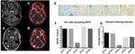 SSTR2 Antibody in Immunohistochemistry, Immunohistochemistry (Paraffin) (IHC, IHC (P))