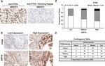 PTEN Antibody in Immunohistochemistry (IHC)