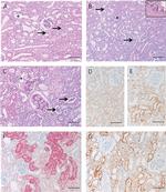 LAMP-2A Antibody in Immunohistochemistry (IHC)