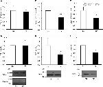 GANAB Antibody in Western Blot (WB)