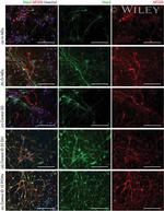 MAP2 Antibody in Immunocytochemistry (ICC/IF)