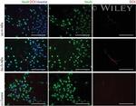 Doublecortin Antibody in Immunocytochemistry (ICC/IF)