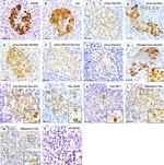 Phospho-Tau (Ser262) Antibody in Immunohistochemistry (IHC)