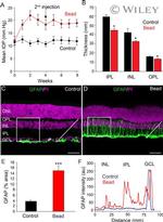 GFAP Antibody in Immunohistochemistry (IHC)