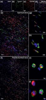 CD169 Antibody in Immunocytochemistry (ICC/IF)