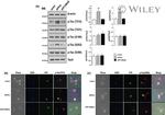 Phospho-Tau (Thr212) Antibody in Immunocytochemistry (ICC/IF)