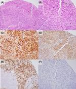 Survivin Antibody in Immunohistochemistry (IHC)