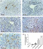 Bcl-2 Antibody in Immunohistochemistry (IHC)