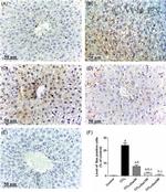 Bax Antibody in Immunohistochemistry (IHC)