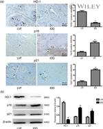 HMOX1 Antibody in Western Blot, Immunohistochemistry (WB, IHC)