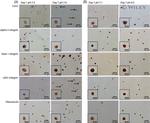 Fibronectin Antibody in Immunohistochemistry (IHC)