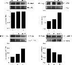 GST Omega 1 140A Antibody in Western Blot, Immunoprecipitation (WB, IP)