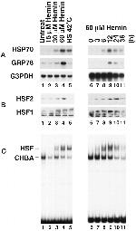 HSF1 Antibody in Western Blot (WB)