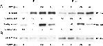 E-cadherin Antibody in Neutralization (Neu)