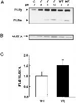 Phospholamban Antibody in Western Blot (WB)