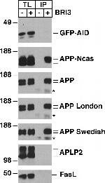 beta Amyloid Antibody in Western Blot (WB)