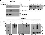 alpha Actinin 4 Antibody in Western Blot (WB)