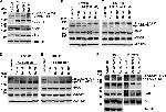 Phospho-FAK (Tyr861) Antibody in Western Blot (WB)