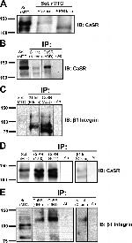 Calcium Sensing Receptor Antibody in Western Blot, Immunoprecipitation (WB, IP)