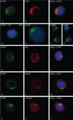 gamma Tubulin Antibody in Immunocytochemistry (ICC/IF)