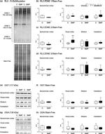 O-linked N-acetylglucosamine (O-GlcNAc) Antibody in Western Blot (WB)