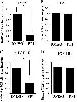 Phospho-IR/IGF1R (Tyr1158, Tyr1162, Tyr1163) Antibody in Western Blot (WB)