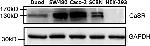 Calcium Sensing Receptor Antibody in Western Blot (WB)