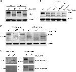 EphB2 Antibody in Western Blot (WB)