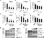 ADAMTS5 Antibody in Western Blot (WB)