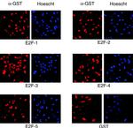 GST Tag Antibody in Immunocytochemistry (ICC/IF)