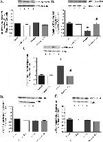 Phospho-eIF2b epsilon (Ser539) Antibody in Western Blot (WB)