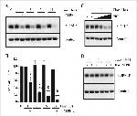 Prolactin Receptor Antibody in Western Blot (WB)