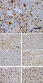 Amyloid Precursor Protein Antibody in Immunohistochemistry (IHC)