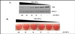 VDR Antibody in Western Blot (WB)