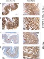 ATP4B Antibody in Immunohistochemistry (IHC)