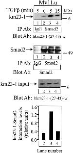 SMAD2 Antibody in Western Blot, Immunoprecipitation (WB, IP)