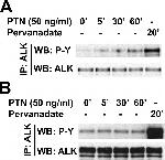 ALK Antibody in Western Blot, Immunoprecipitation (WB, IP)