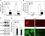 Estrogen Receptor beta Antibody in Western Blot (WB)