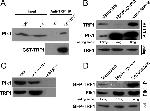 PLK1 Antibody in Western Blot, Immunoprecipitation (WB, IP)