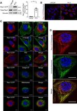 Golgin-97 Antibody in Immunocytochemistry (ICC/IF)