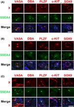 PLZF Antibody in Immunohistochemistry (IHC)