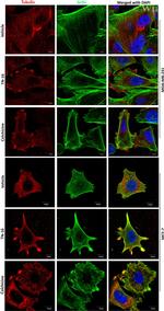 beta Tubulin Antibody in Immunocytochemistry (ICC/IF)