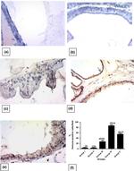 Active Caspase 3 Antibody in Immunohistochemistry (IHC)