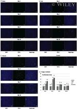 PCNA Antibody in Immunohistochemistry (IHC)