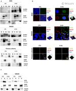 GM130 Antibody in Immunocytochemistry (ICC/IF)