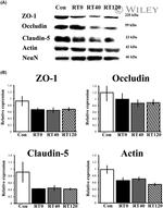 Occludin Antibody in Western Blot (WB)