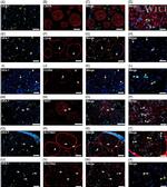 Claudin 4 Antibody in Immunohistochemistry (IHC)